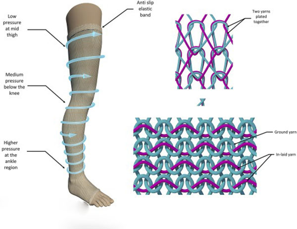 Medical compression stocking diagram showing pressure zones and knit fabric structure